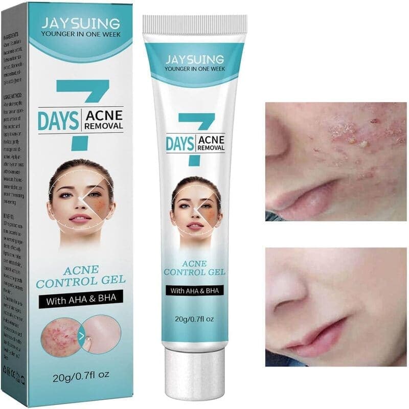 Crema tratamiento acne mascarilla facial