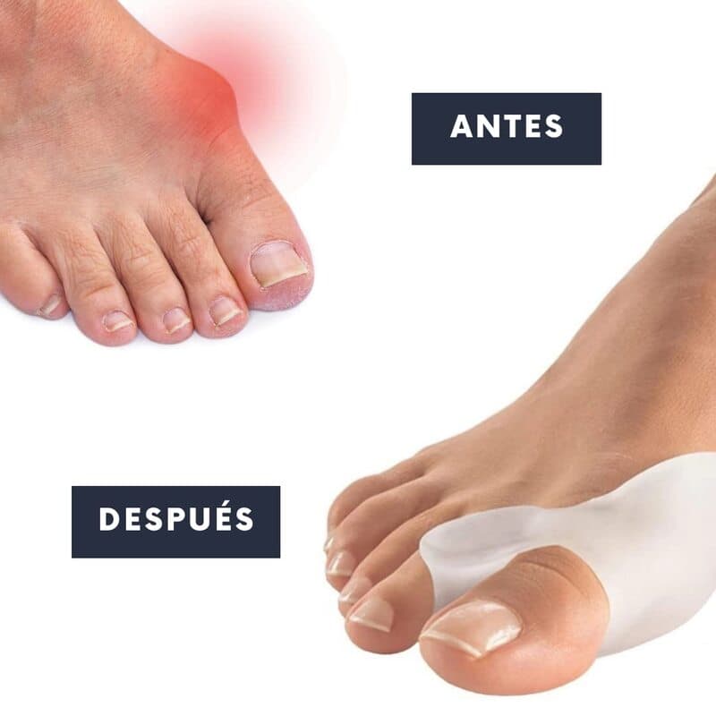 Separador Corrector Dedos Pie Silicona
