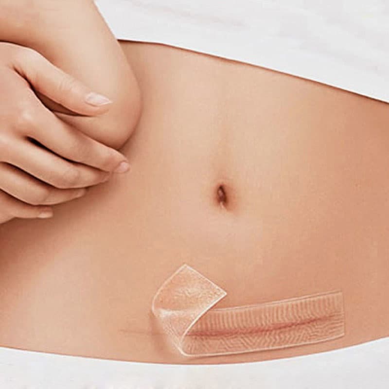 Cinta silicona eliminación de cicatrices